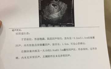 女性染色体异常有2种类型！包括以下项目！-试管包男女