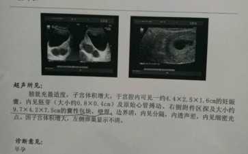 苏州三代试管的流程是怎么样的？苏州三代试管攻略大全-试管代生哪家强